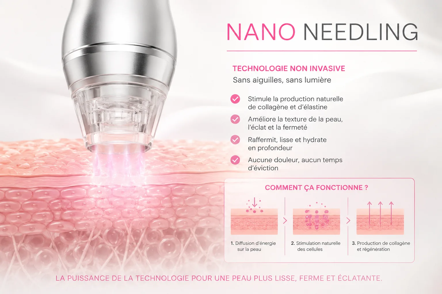 nanoneedling nice 1